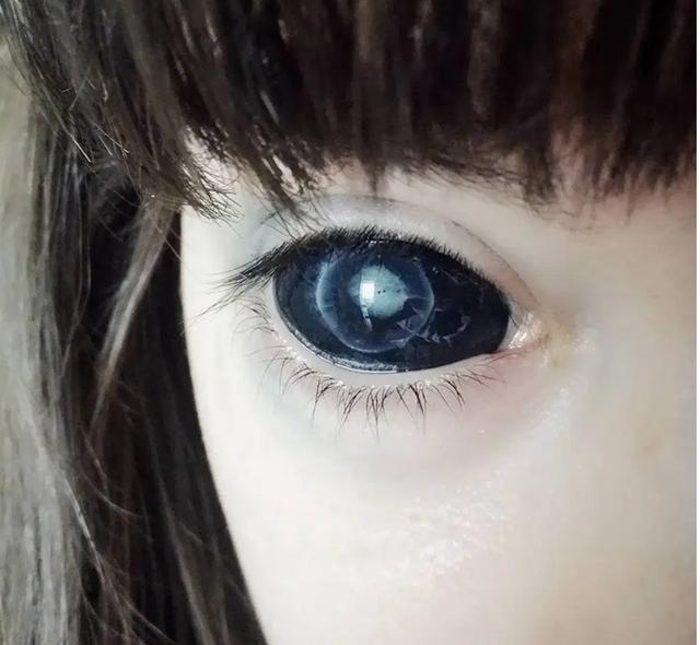 婴儿的眼睛白眼球是蓝色的_婴儿白眼珠子发蓝_婴儿眼睛白眼球发蓝