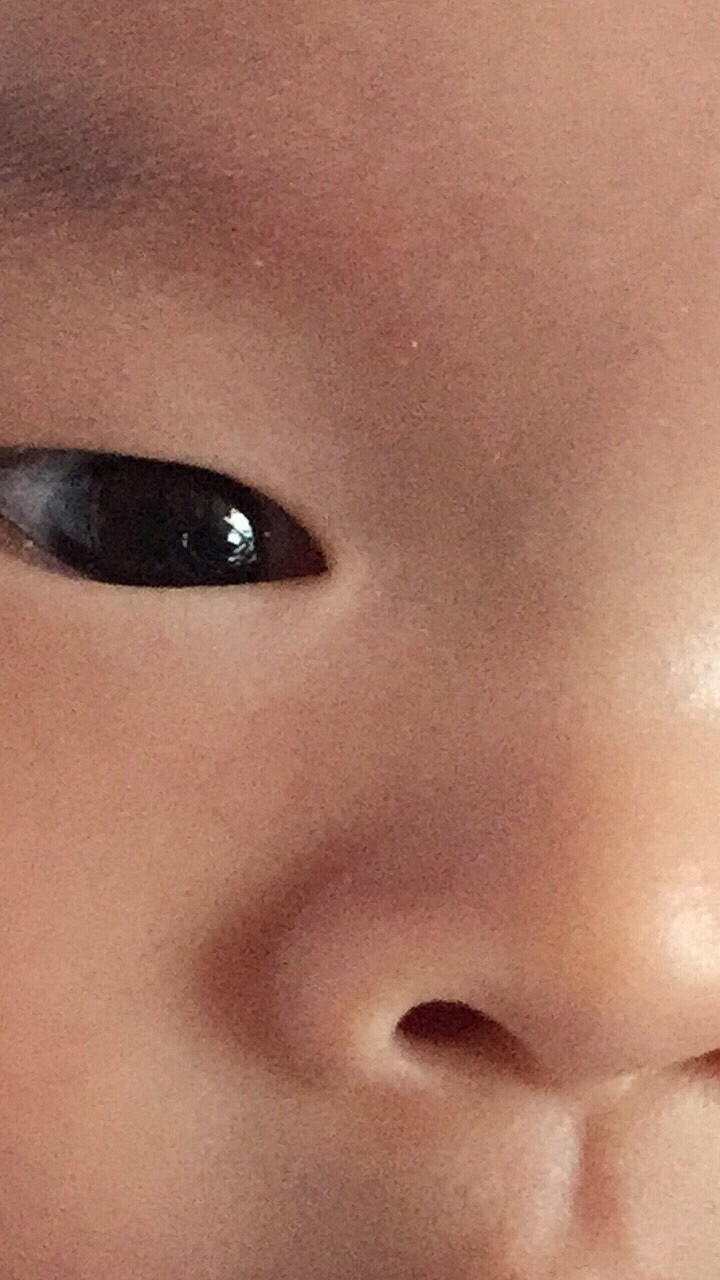 婴儿白眼珠子发蓝_婴儿的眼睛白眼球是蓝色的_婴儿眼睛白眼球发蓝
