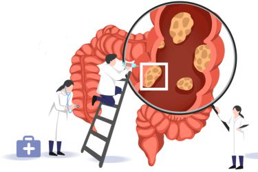 克罗恩病(cd)_罗克罗恩病_罗恩科病