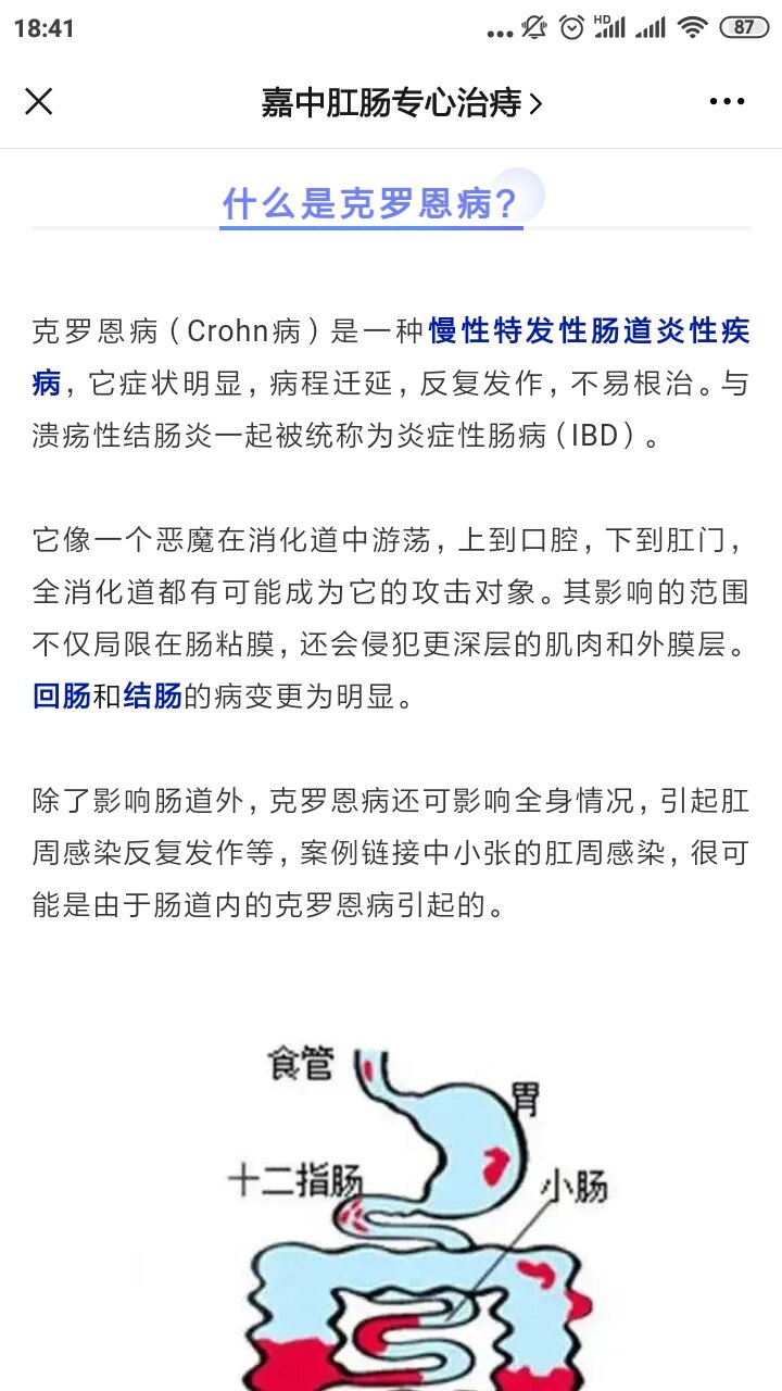 克罗恩病线样征_克罗恩病线样征_克罗恩病线样征