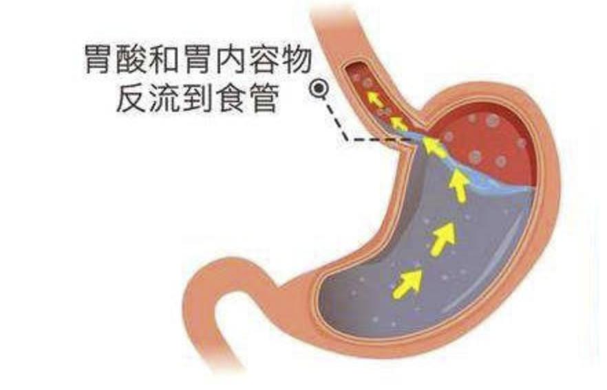 中里巴人胃炎_中里巴人论坛胃病_中里巴人治疗胃不舒服