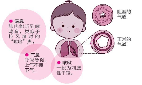 哮喘运动会好吗_哮喘运动后会加重吗_有哮喘的运动员
