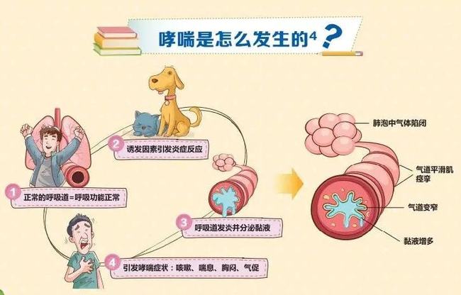 工作强度大,哮喘会范吗_哮喘情况严重会直接影响什么_哮喘加重会变成什么
