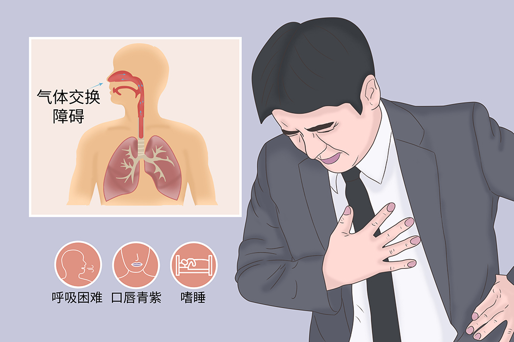 呼吸定义衰竭的标准_呼吸定义衰竭名词解释_呼吸衰竭定义