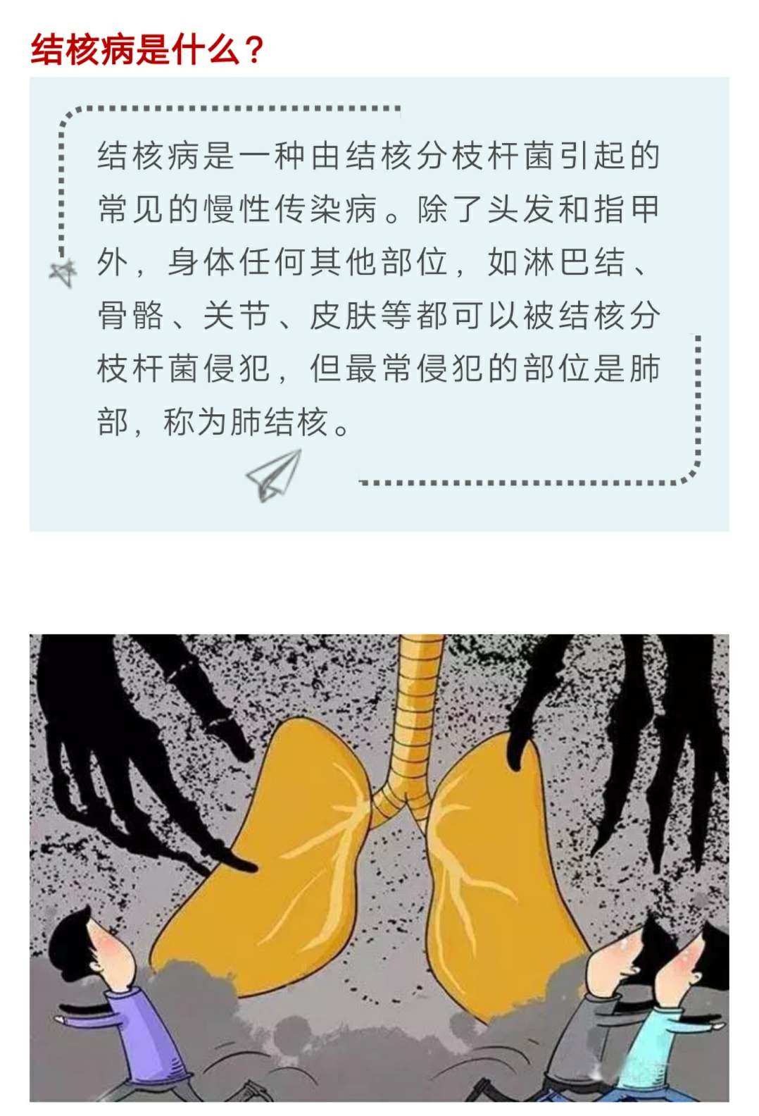 肺结核的严重程度分类_肺结核严重性_三型肺结核严重吗