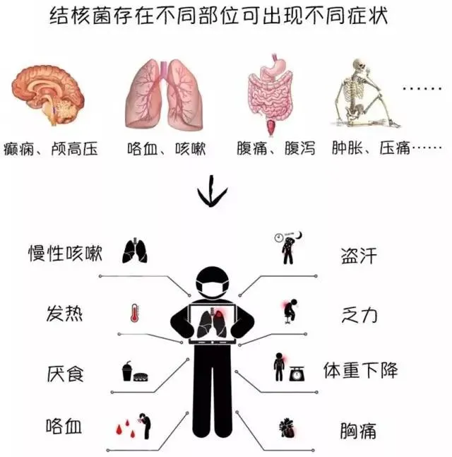 三型肺结核严重吗_肺结核的严重程度分类_肺结核严重性