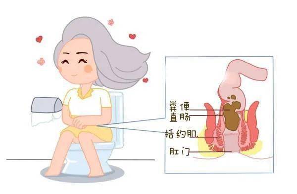 大便肛门闭锁失禁怎么治疗_大便肛门闭锁失禁吃什么药_肛门闭锁大便失禁
