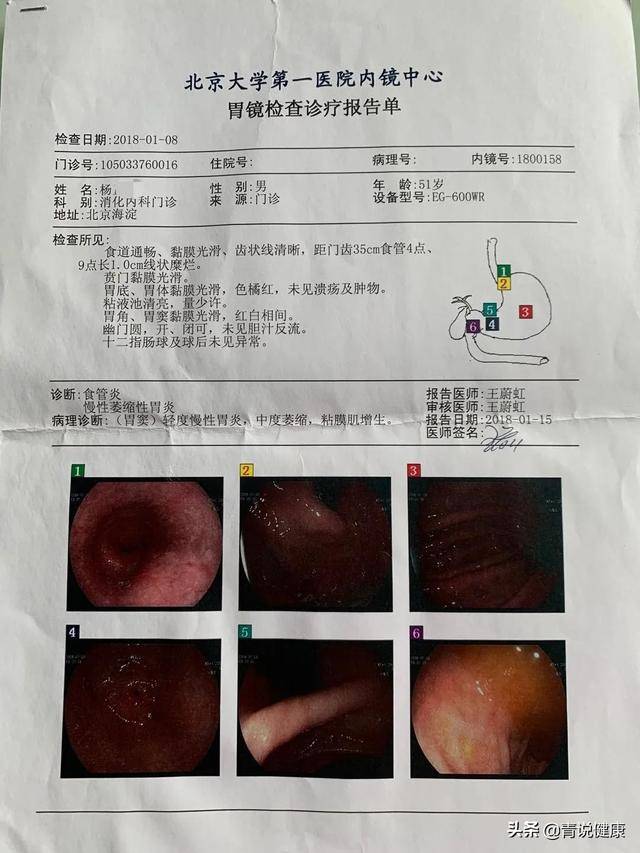 胃病治愈论坛_彻底根治所有胃病奇方_根治胃病论坛