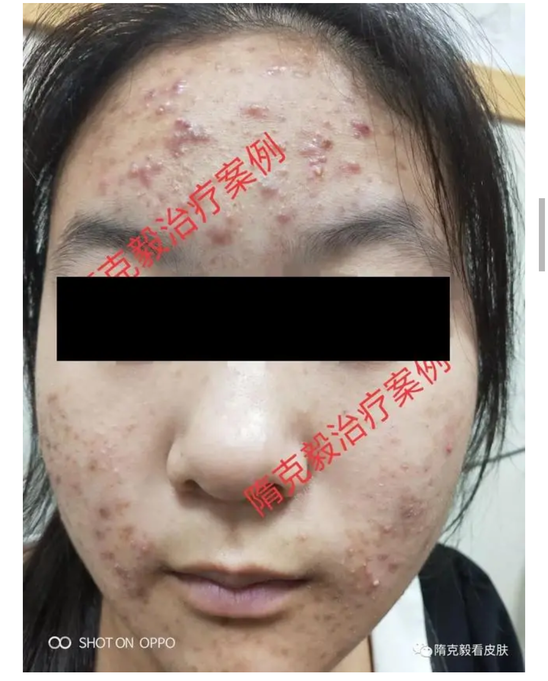 朝阳中医医院挂号处电话_朝阳区中医医院_朝阳中医医院门诊时间