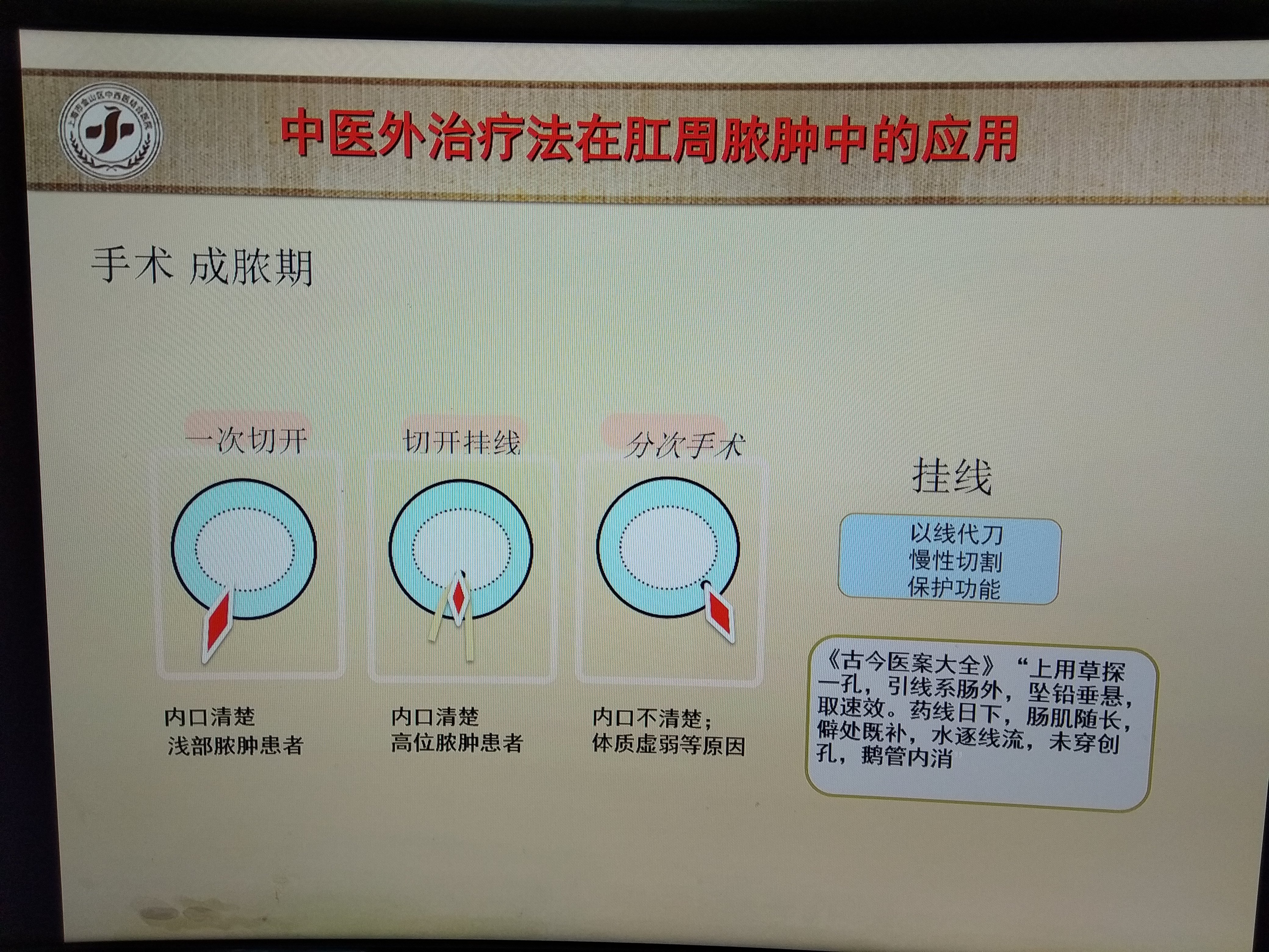 肛门失禁有救吗_肛门失禁最常见的并发症_肛门失禁怎么护理