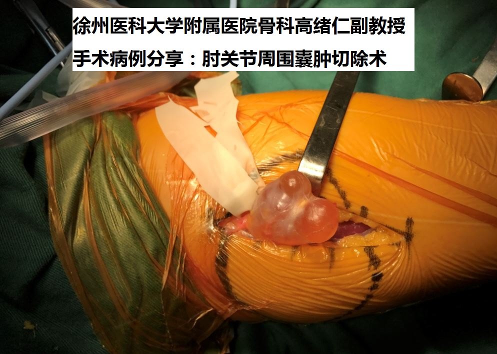 病例冠心病疑难讨论范文_冠心病疑难病例讨论_病例冠心病疑难讨论怎么写