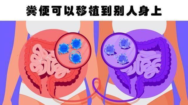 男友插肛门 大便失禁_大便失禁肛门袋_肛门被大便