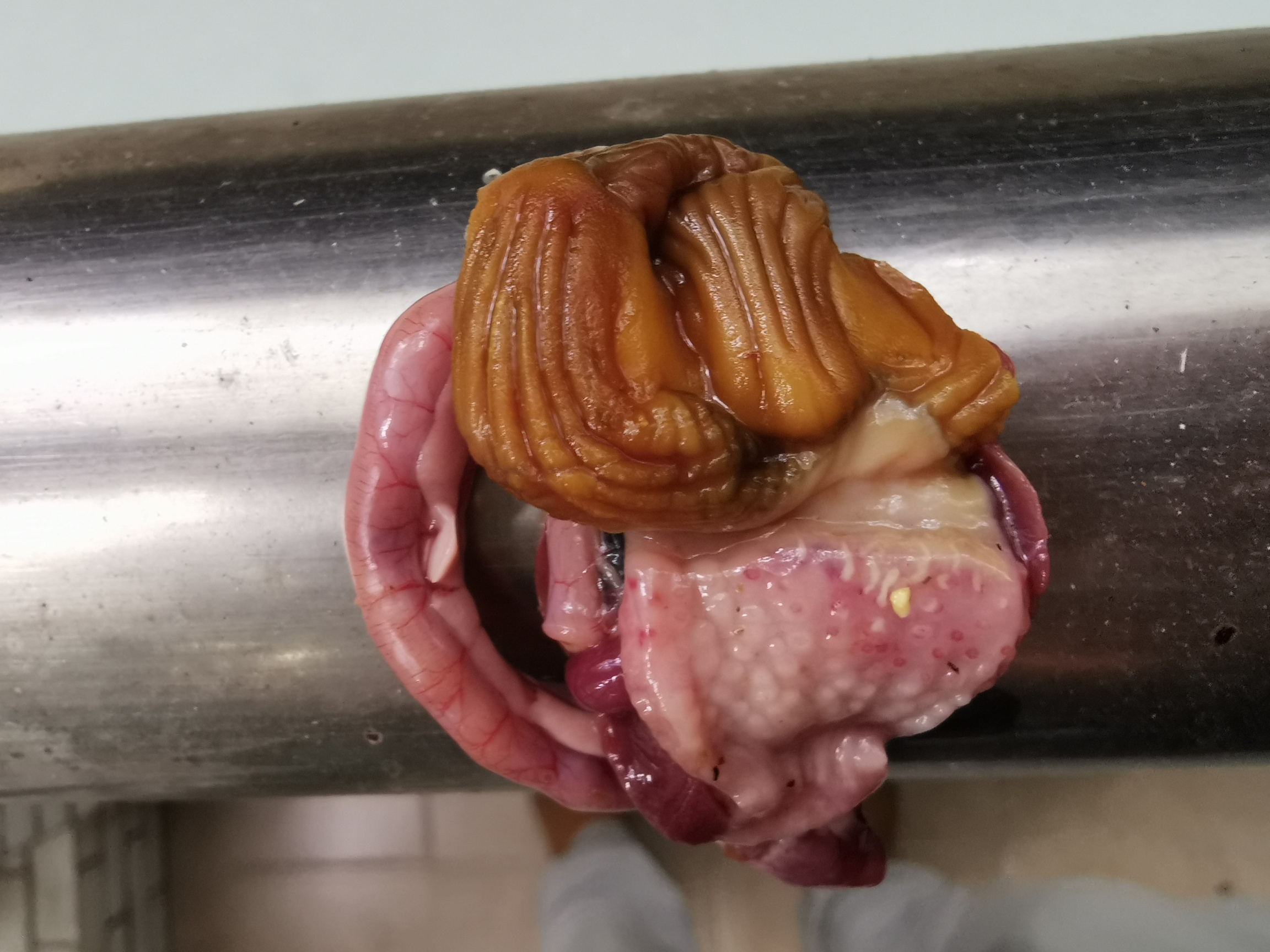 中里巴人胃炎_中里巴人论坛胃病_中里巴人胃炎治疗方法