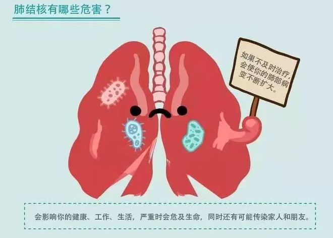 肺结核咳白痰有传染性吗_肺结核咳白痰_肺结核咳嗽白痰怎么办