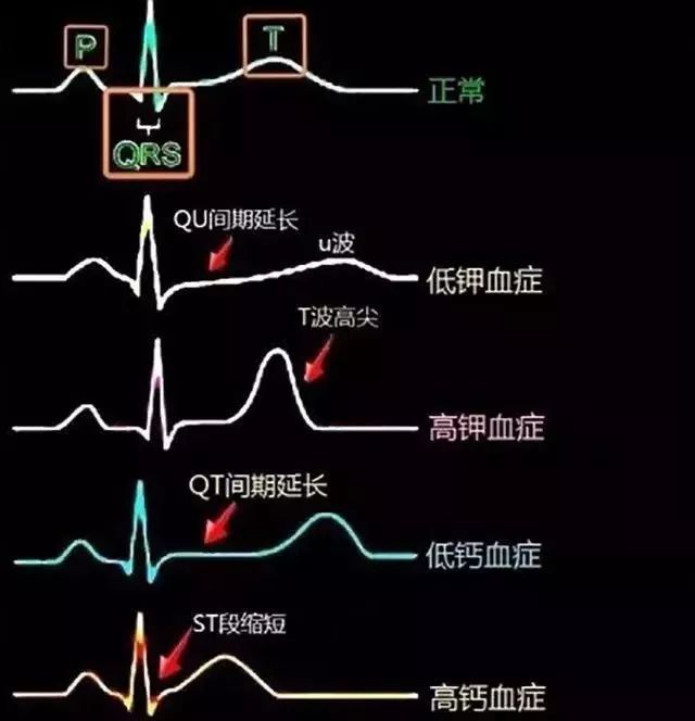 高血压冠心病怎么调理_调理血压冠心病高的中药_调理血压冠心病高吃什么药