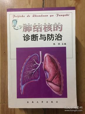 肺结核继发性严重吗_继发性肺结核会自愈_继发性肺结核多久能好