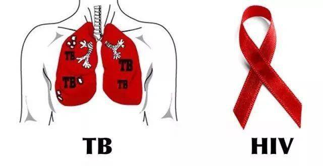 肺结核性继发注意哪些事项_继发性肺结核要注意哪些饮食_继发性肺结核注意什么