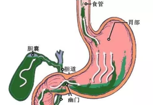 胃病论坛 健康_胃病健康讲座_胃病病友论坛