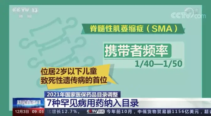 脊髓性肌萎缩症是_脊髓性肌萎缩症的临床实践指南_脊髓性肌萎缩症