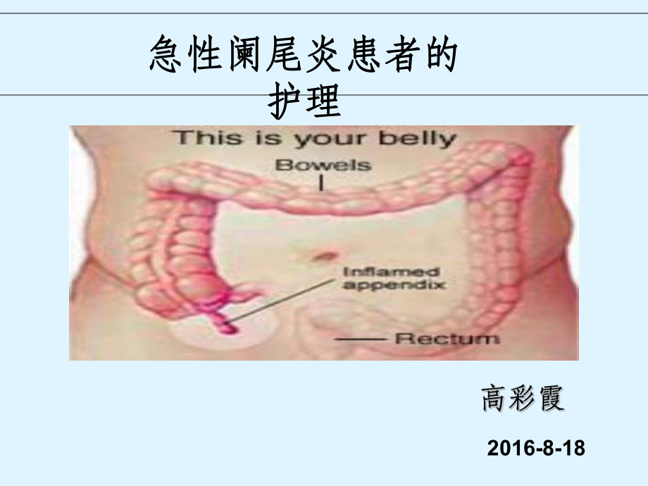 简述急性阑尾炎的护理措施_急性阑尾炎术后护理简答题_急性阑尾炎护理常规试题