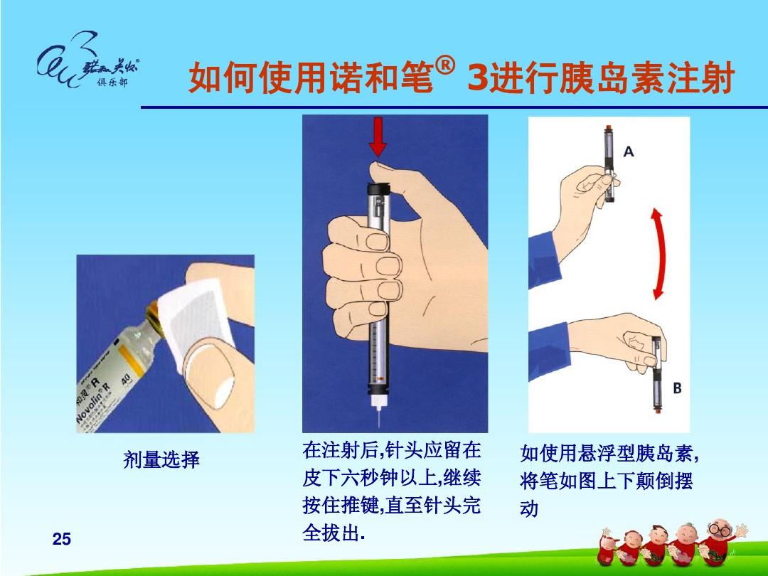 多长手术肛瘘时间要切除_肛瘘手术要多长时间_多长手术肛瘘时间要换药