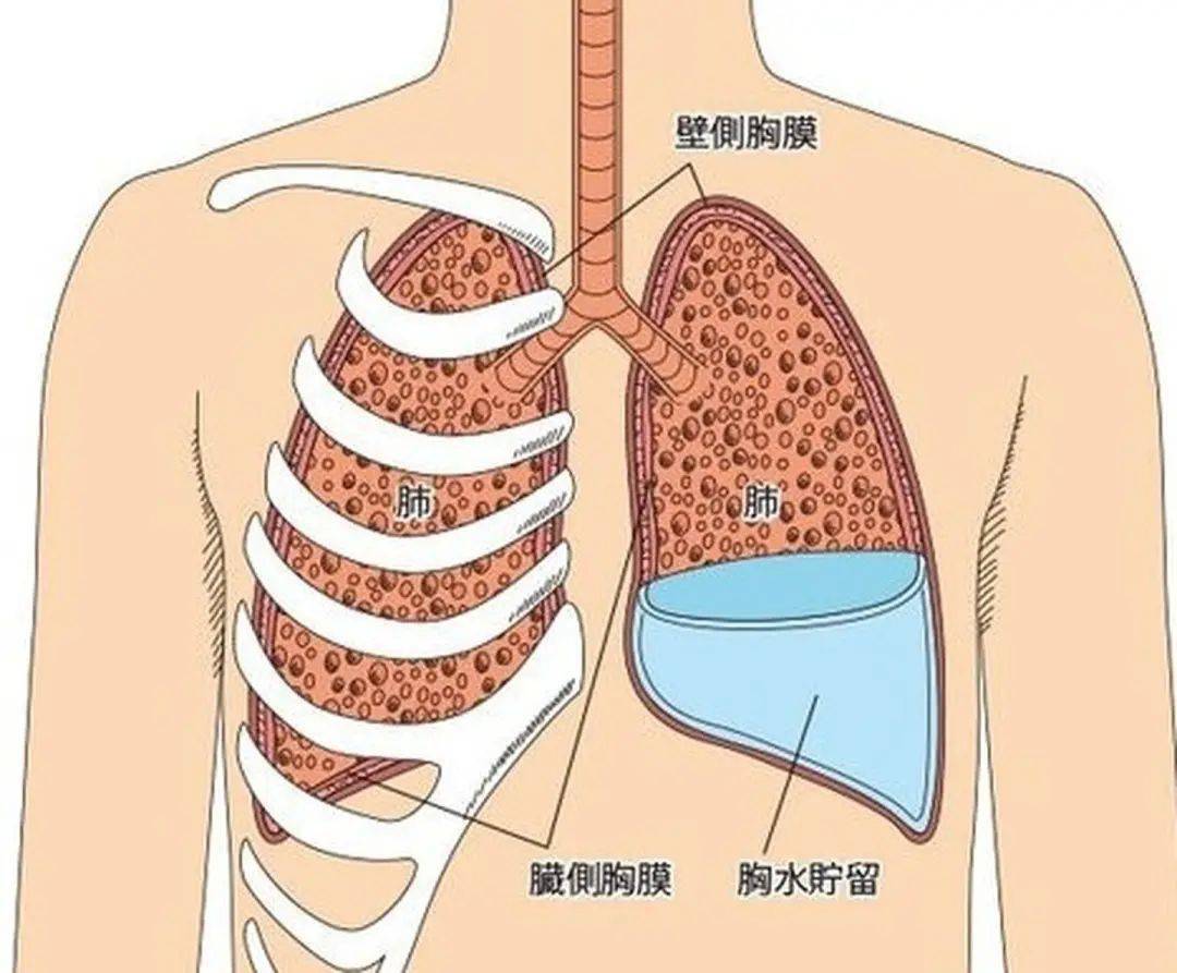 肺白是怎么回事_肺白是什么病_白肺症状