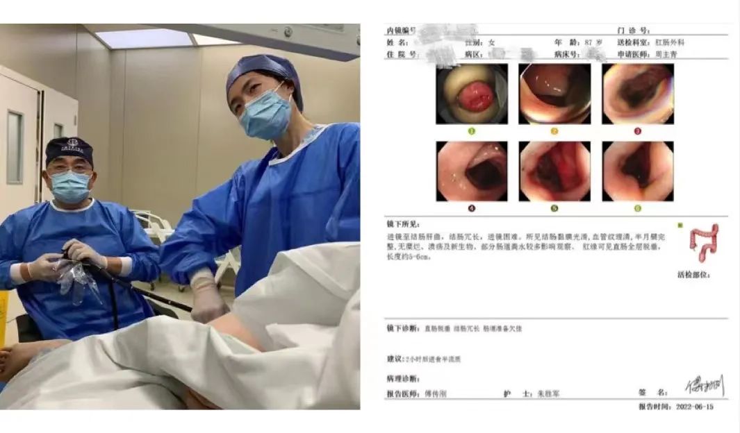 小孩肛门失禁_肛门小孩失禁怎么治疗_肛门失禁能自愈吗
