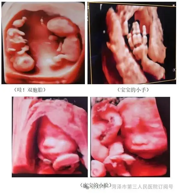 哪能做四维检查_四维检查做多久_能四维检查做四维吗