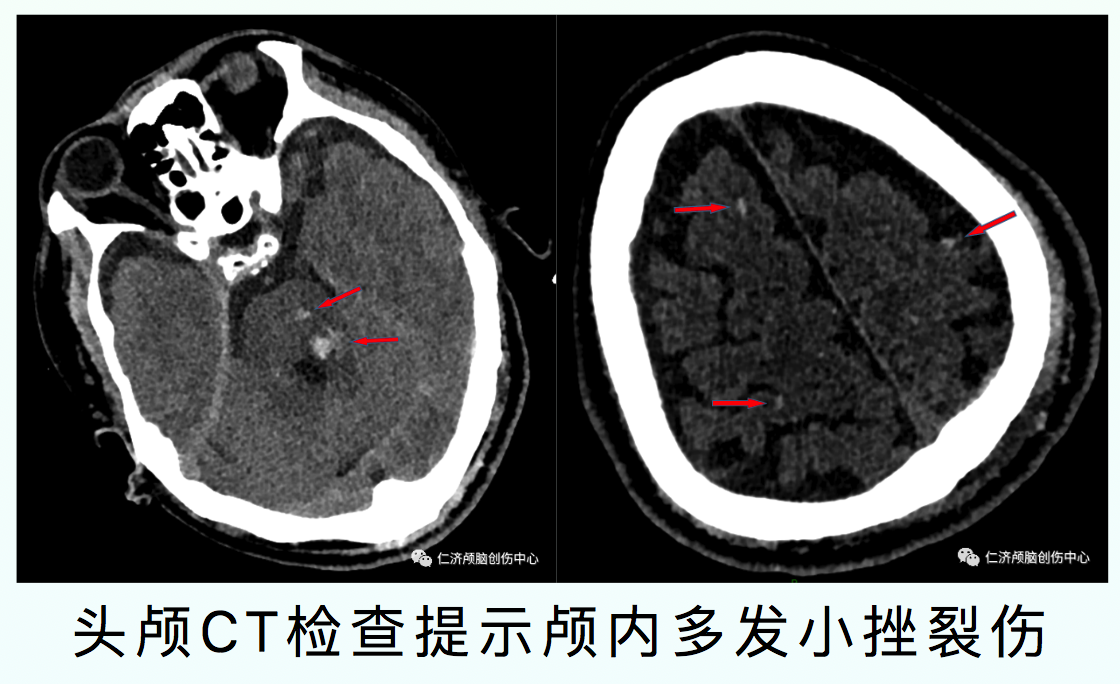xp home sp3 序列号_序列号在包装盒哪里_序列号查询苹果官网