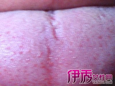 手臂出血小红点_手臂上有很多小红点渗血_手臂红点出血