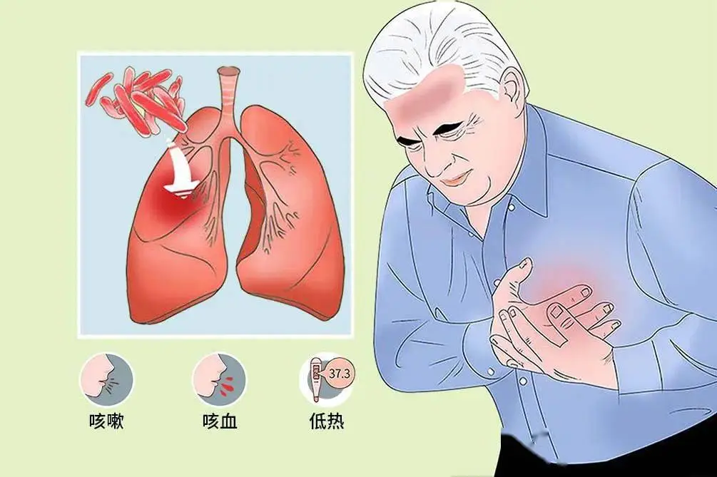 空洞型肺结核注意什么_空洞型肺结核注意事项_肺空洞结核型注意什么饮食