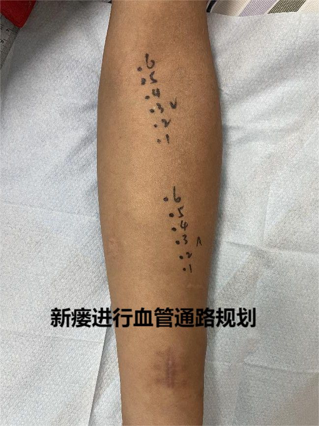 朝阳二医院妇科电话_朝阳妇科医院咨询免费咨询_朝阳妇科医院电话号码