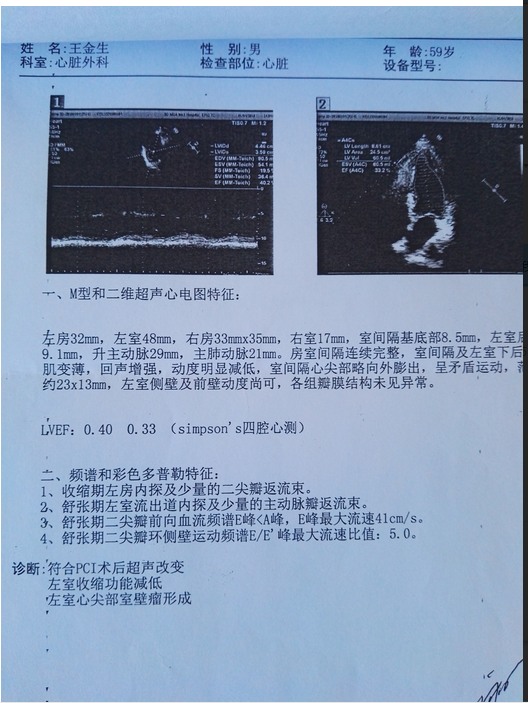 治疗心梗介入性手术复杂_心梗介入适应症_心梗介入治疗并发症