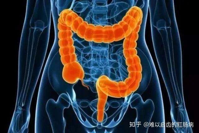 肛门失禁治疗方法_肛门失禁的临床表现_肛门失禁图片
