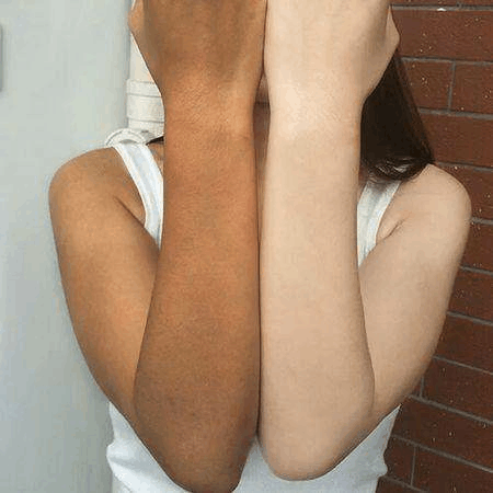 脸皮掉皮屑_脸上掉皮屑_脸部掉皮屑是什么原因