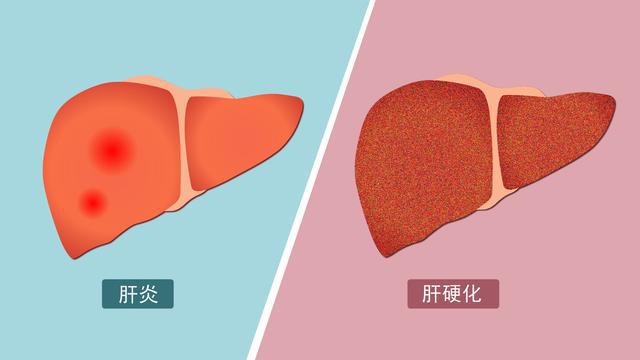 天涯论坛胃癌_天涯医院胃癌晚期论坛_天涯胃病吧