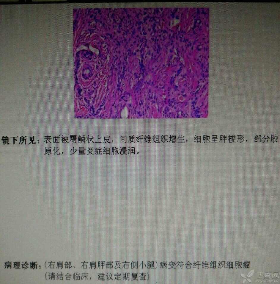 取病例需要本人吗_医院取病例需要啥_去医院取病例需要什么