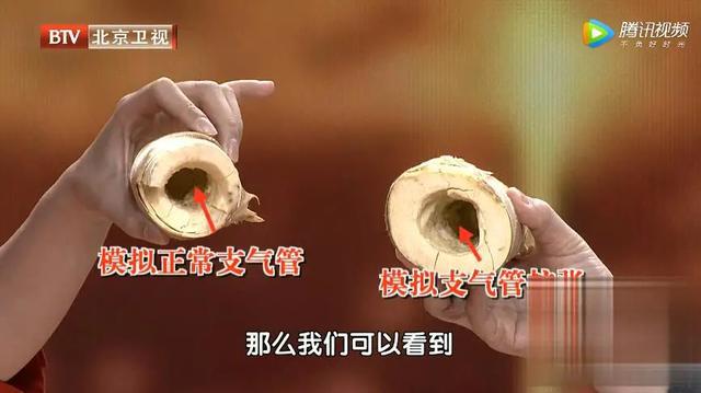 感冒发烧咳嗽喉咙痒_感冒咳嗽喉咙痒发烧吃什么药_感冒发烧后咳嗽烟痒怎么办
