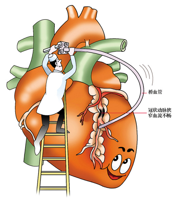 护理冠心病患者的心得体会_冠心病及护理ppt_护理冠心病情景剧剧本