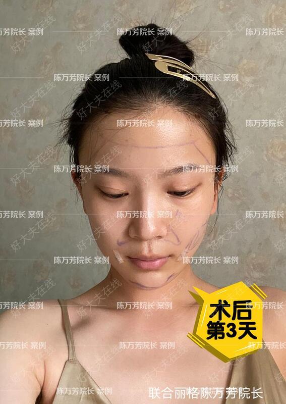 肛瘘挂线手术脱线征兆_肛瘘挂线手术多久掉线_肛瘘挂线手术掉线时间