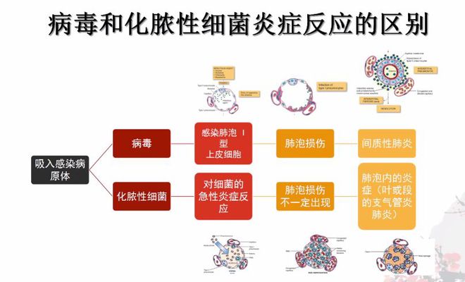 肺炎治疗一般需要多少天_肺炎治疗疗程_肺炎 怎么治疗
