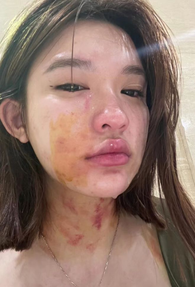 电梯监控接线图_电梯监控布线图解_电梯监控布线视频教程